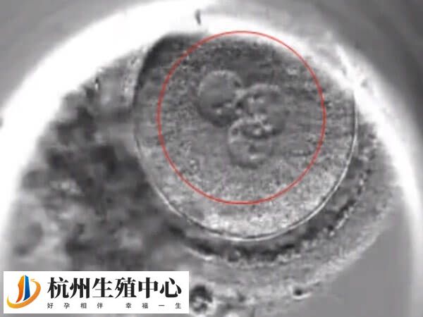 囊胚嵌合比例大于40%容易被选择淘汰