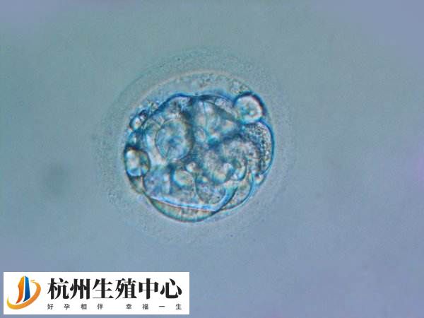 前列腺癌可能会影响男性的生殖系统