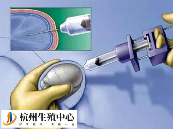 睾丸活检