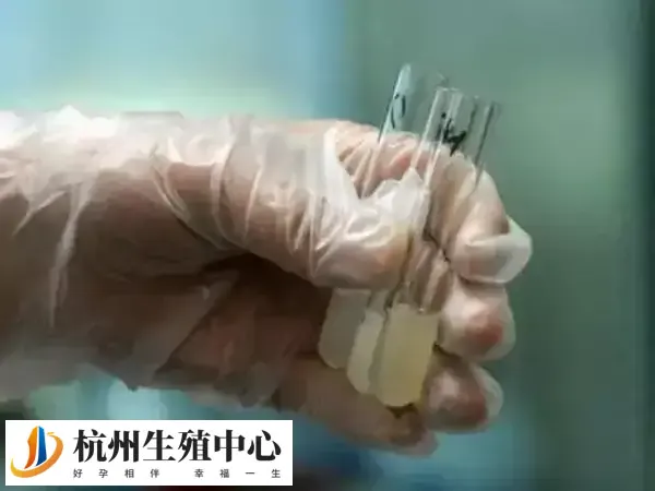 附睾抽吸精子适用于射精困难的人