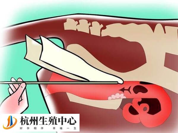 成功率低是不建议做人工授精的原因之一